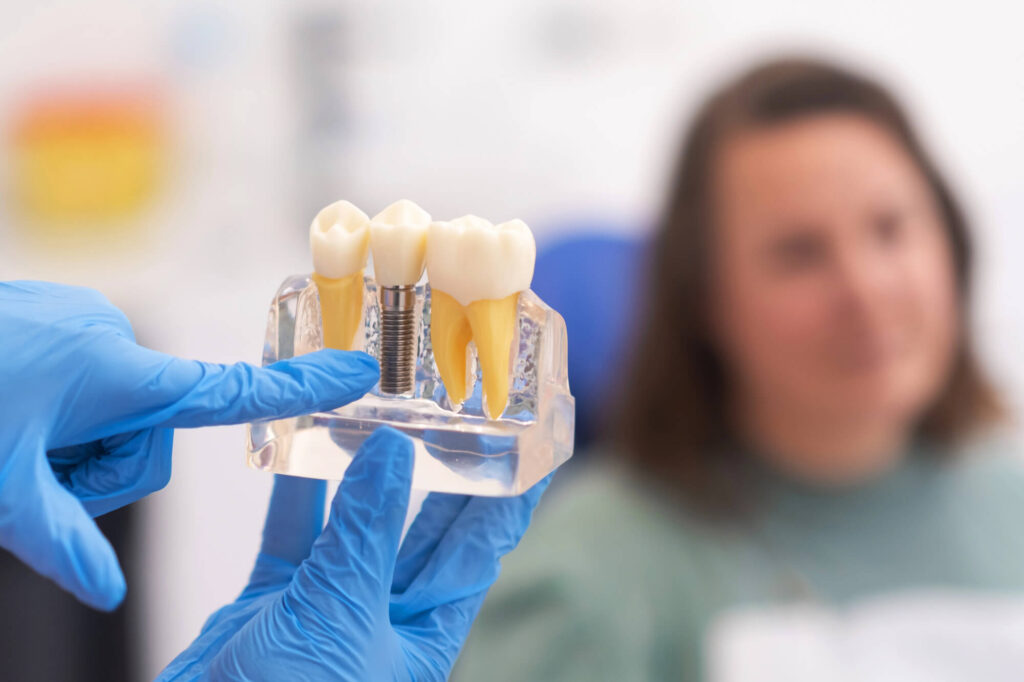 4 Signs It’s Time To Consult An Oral Surgeon About Implants